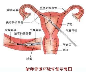 通草的功效与作用能通输卵管堵塞_最新热门核心解析14.145.25.208